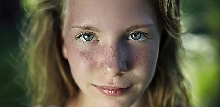 Model's freckled face captured outdoors backlit with natural sunlight