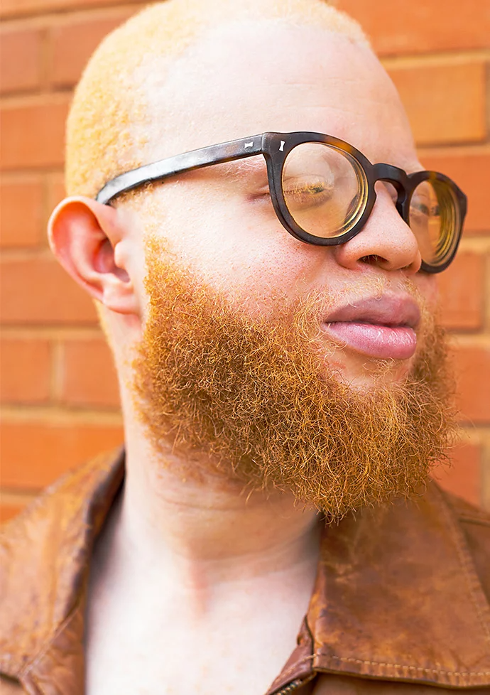 Photo of a person's face side profile in front of a brick wall