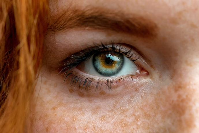 close-up-of-one-eye-of-young-red-ginger-freckled-woman-with-perfect-healthy-freckled-skin-looking-at-camera-ophthalmology-vision-care