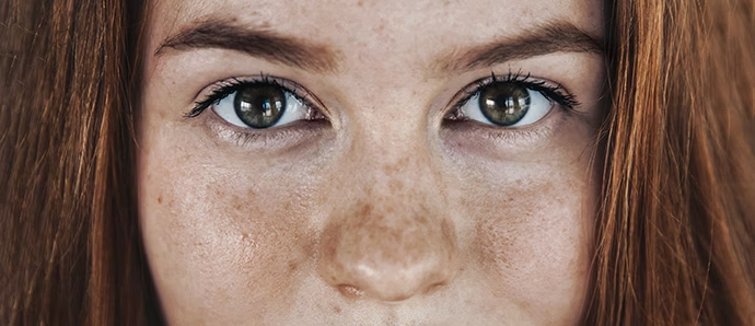 eyes-face-beautician-freckles-teenager-portrait-with-healthy-skin-and-red-hair-foxy-hair-ginger-girl